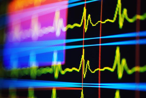 Point-of-care screening for atrial fibrillation (A-fib) using a new generation of handheld electrocardiogram (ECG) devices increased the rate of diagnosis in patients 85 and older, but failed to show similar results in those 65 and older, a study by Massachusetts General Hospital (MGH) has found. 