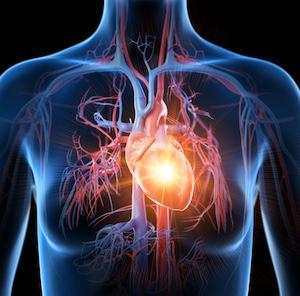 Heart attack, statins, 