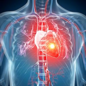 Global Experts Update Heart Failure Definition