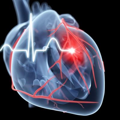 Abbott Technologies Included in Updated ESC Heart Failure Guidelines