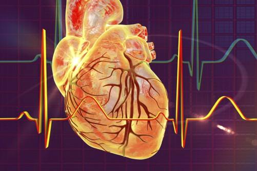 The algorithm may help clinicians find atrial fibrillation in people without symptoms 