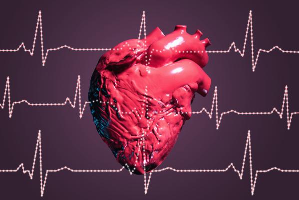 cardiac output, algorithm, 