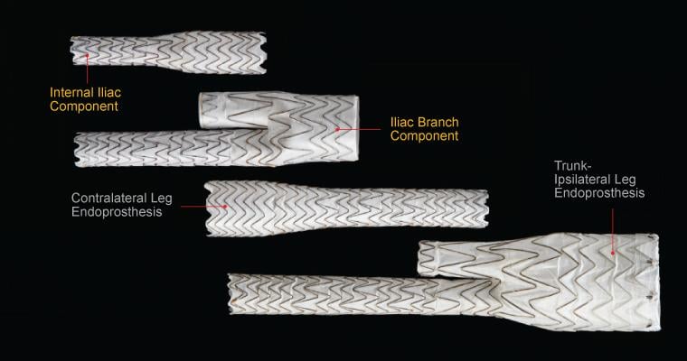 Gore Medical, Excluder Iliac Branch Endoprosthesis, FDA approval