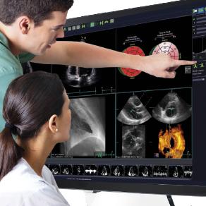 TomTec offers innovations in cardiac ultrasound, including AI and auto quanitification of echo images.
