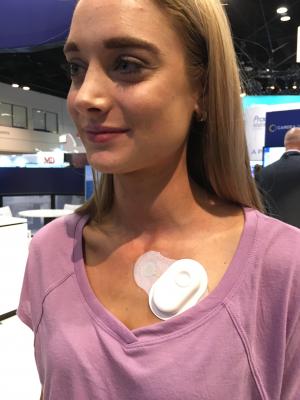 An example of the new generation of inexpensive, wearable cardiac monitors. This is the Cardiac Insight Cardea Solo device. #ACC18