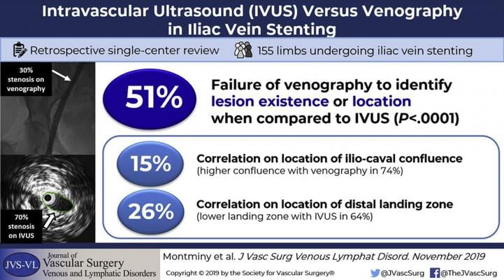 A comparison of intravascular ultrasound (IVUS) vs. angiography found a significant mismatch and showed the benefits of IVUS in venous interventions.