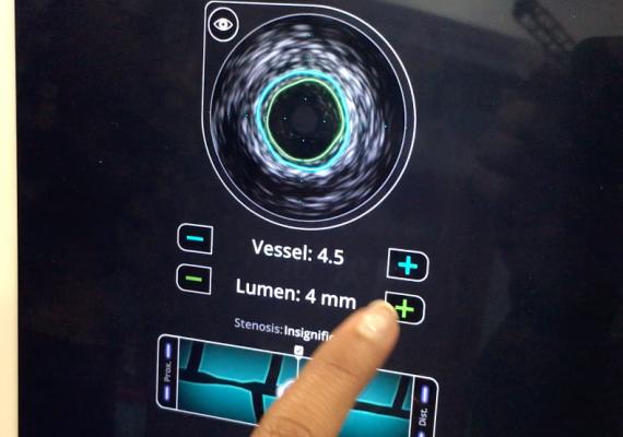 This is a view of the Level Ex IVUS training app to help users of Philips' intravascular ultrasound system. It is integrated into a percutenous coronary intervention (PCI) training app for mobile devices that allows interventional cardiologists to perform streamlined cath lab patient case simulations, including, iFR, angioplasty and stenting. #TCT2019