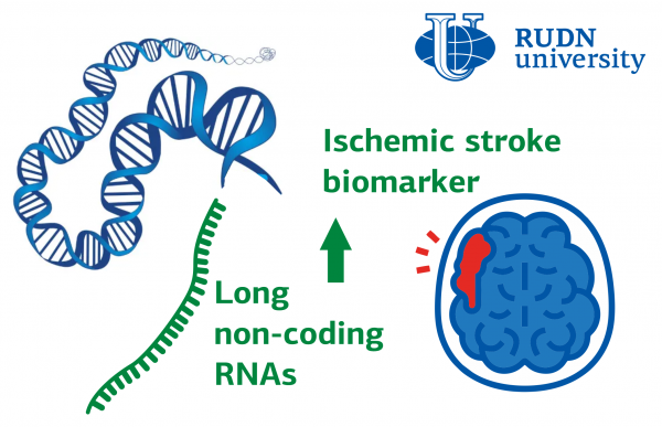 RUDN doctors analyzed the latest research on the use of RNA for the treatment and diagnosis of ischemic stroke. And, although it is too early to talk about clinical use, one of the RNAs turned out to be both a promising biomarker and a therapeutic target 