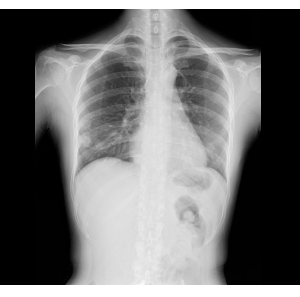 Researchers Publish Study on DDR-Based Technique for Assessing Heart Valve Regurgitation 