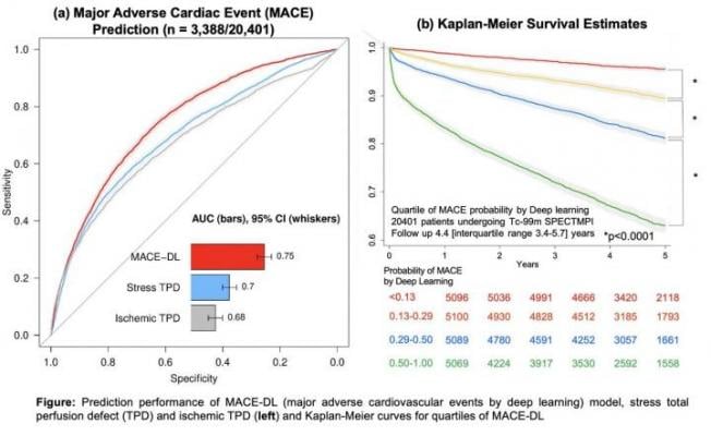 Prediction performance of DL compared to quantitative measures and Kaplan-Meier curves for quartiles of DL. Image created by Singh et al., Cedars-Sinai Medical Center, Los Angeles, CA.