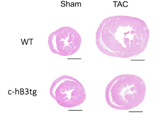 Transverse heart sections from wild type mice (WT) and transgenic mice overexpressing beta-3 adrenergic receptor in cardiomyocytes (c-hB3tg) after 3 months of aortic stenosis (transaortic constriction, TAC) or control (sham). Hypertrophy after TAC was less severe in the transgenic mice. Courtesy of CNIC 