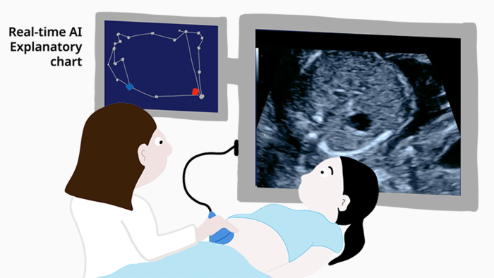 Researchers from the RIKEN Center for Advanced Intelligence Project (AIP) and colleagues have tested AI-enhanced diagnosis of fetal congenital heart disease in a clinical setting. 