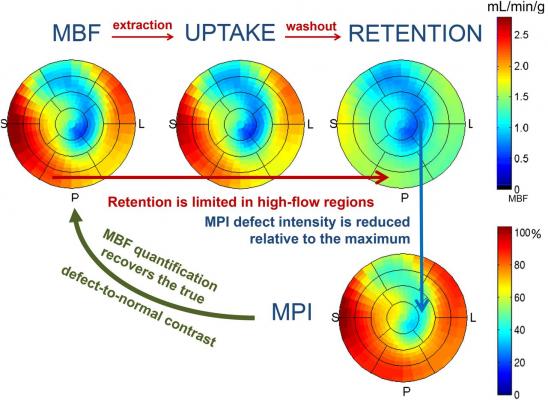Polar maps demonstrating MBF, uptake, and retention along with their relationship to traditional relative MPI. 