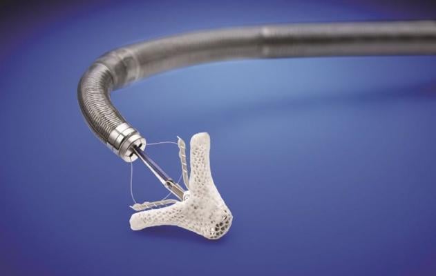 MitraClip, Abbott, transcatheter mitral valve repair, FDA approval