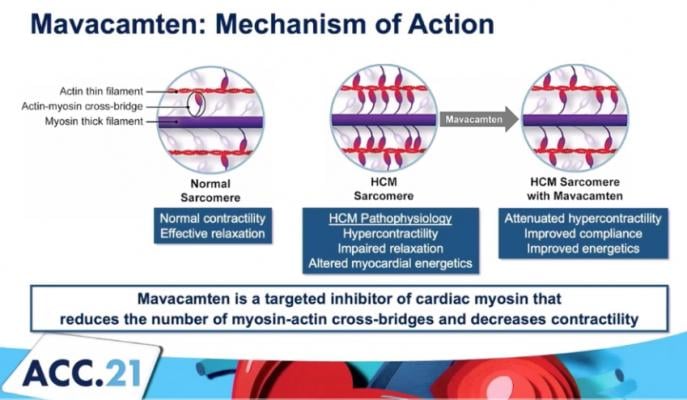 The mechanism of action for mavacamten, a cardiac myosin inhibitor to treat obstructive hypertrophic cardiomyopathy (oHCM). EXPLORER-HCM trial #ACC21 #ACC2021