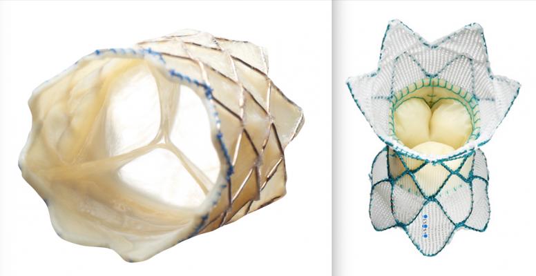 Left, the Melody pulmonary valve was the first transcatheter valve to be approved by the FDA in the United States a decade ago. Right, the Harmony transcatheter valve is in trials and is designed to treat patients with RVOT anomalies who develop severe PR typically when a pervious repair fails. Both valves are used to treat congenital heart defects. #SCAI #SCAI2020