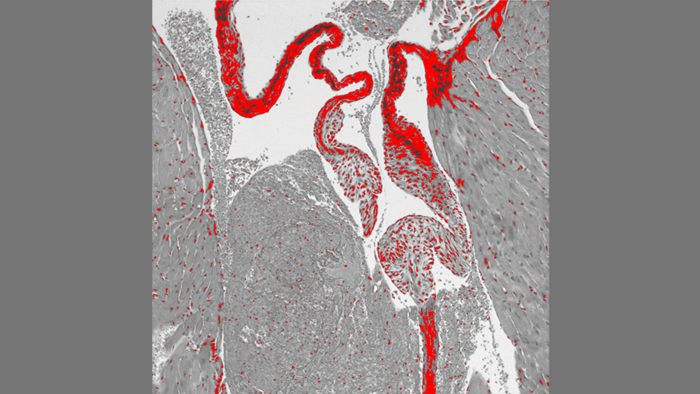 This image shows the mitral valve of the heart of a mouse that lacks the serotonin transporter (SERT) gene. The valve was stained with prico-sirius red to show collagen. SERT knockout mice had a thickened mitral valve compared to normal mice. Image courtesy of Columbia University Irving Medical Center 