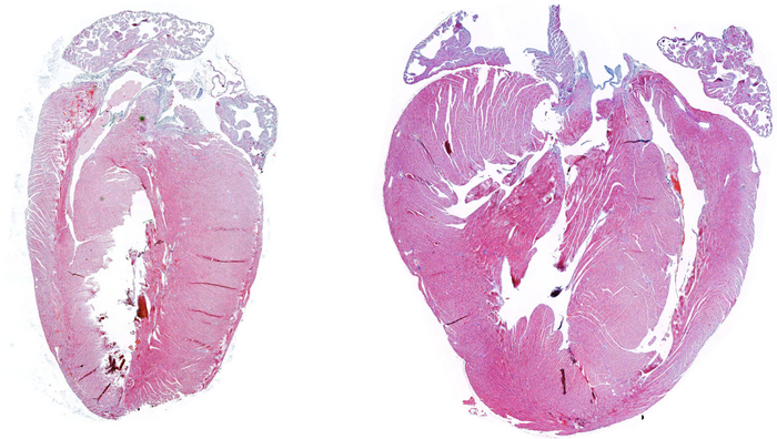 Histological analysis comparing the size of the heart of a normal mouse (left) and a mouse lacking the protein MKK6 (right). Image courtesy of CNIC 