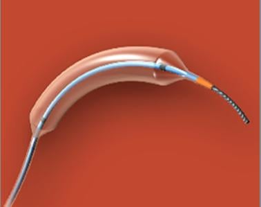 NC Trek RX Coronary Dilatation Catheter is part of an FDA Class I recall because it may not defalte.