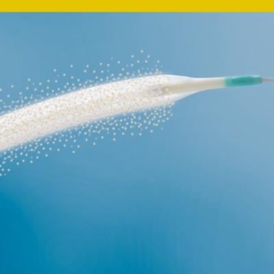 The BIO REACT study was designed to better understand when and where a stent is needed following drug-coated balloon for the treatment of femoropopliteal artery lesions in patients with peripheral artery disease (PAD) 