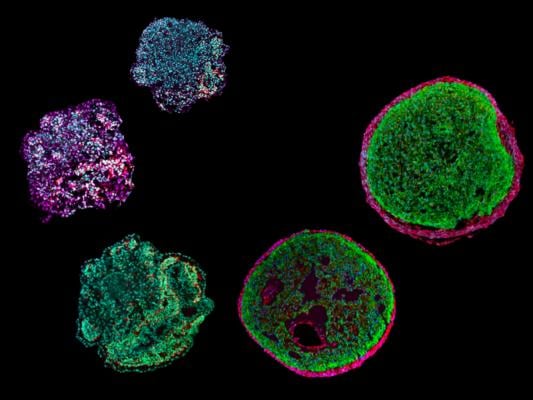 TUM team develops first heart organoid containing cardiac muscle cells and outer layer of the heart wall 