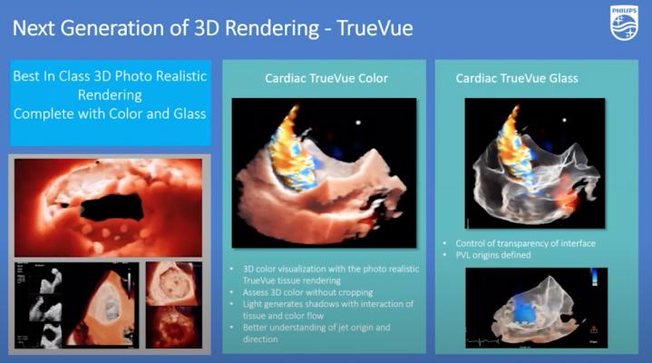 WEBINAR: 3-D Multi-planar Imaging to Enhance Ultrasound Guidance of Interventional Cardiac Procedures using Philips Technology.