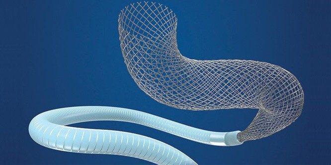 Medtronic is recalling its Pipeline Flex Embolization Device and Pipeline Flex Embolization Device with Shield Technology, which are transcatheter devices used to seal brain aneurysms. The company said there is a risk of the delivery system’s wire and tubes fracturing and breaking off when the system is being used to place, retrieve, or move the stent inside a patient.