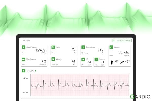 Qardio, a leading innovator in healthcare technology, has unveiled its groundbreaking Livestream solution suite, which includes continuous ECG, Blood Pressure, Pulse Oximetry (SPO2), Body Temperature, Weight, and Body Position monitoring 