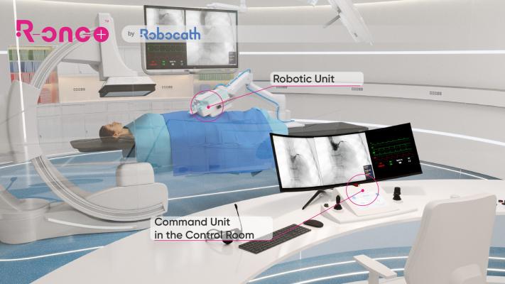 R-One+ is a robotic solution that allows the interventional cardiologist to perform coronary angioplasties by controlling the devices using an integrated control command unit located in the cathlab or in the control room 