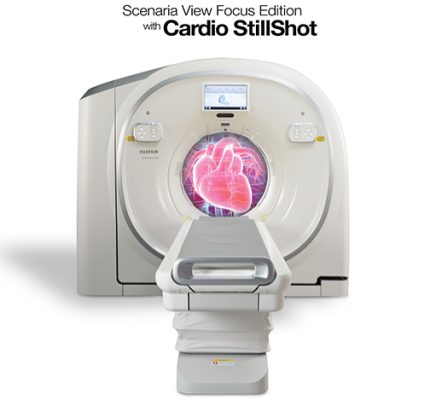 Cardio StillShot enables 6x higher temporal resolution compared to conventional image reconstruction methods by detecting and correcting motion in the heart 