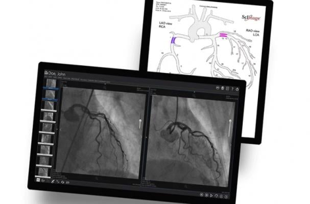 ScImage went live in March at Peak Surgery Center of Avondale, Arizona, and was developed in cooperation with the providers from multispecialty cardiovascular group Peak Heart & Vascular, which has locations in Avondale, Surprise, Ariz., and Flagstaff, Ariz. ScImage’s PICOM365 Cloud provides image review, storage and advanced structured reporting to manage the complex, measurement-centric cardiac catheterization procedures performed in the facilities.
