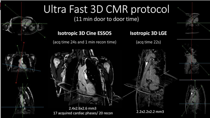 Ultra-fast, less than one-minute scan time, cardiac MRI enables accurate assessment of heart anatomy and function, improves patient comfort, increases access to care, and reduces costs