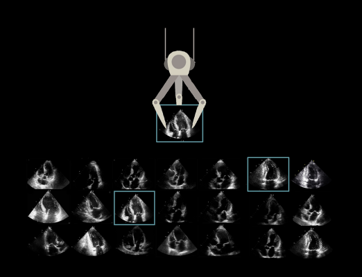 DiA Imaging Analysis Ltd, a leading global provider of AI-powered ultrasound analysis software, announced today a multi-year agreement with Change Healthcare, a global industry-leading provider of enterprise imaging solutions. 