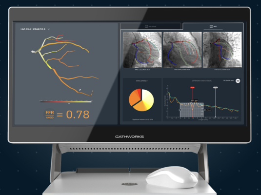 The CathWorks FFRangio System to Be Featured in Multiple Live Cases and Clinical Presentations at TCT 2022 