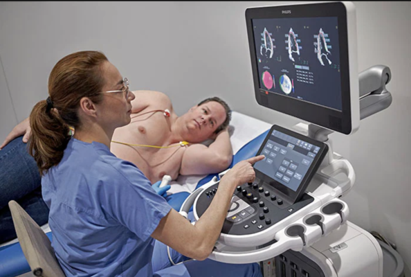 The Delphi study results show Philips’ integrated echocardiography solution provides the tools required for baseline risk stratification and monitoring of cardio-oncology patients as recommended by the latest European Society of Cardiology (ESC) guidelines 