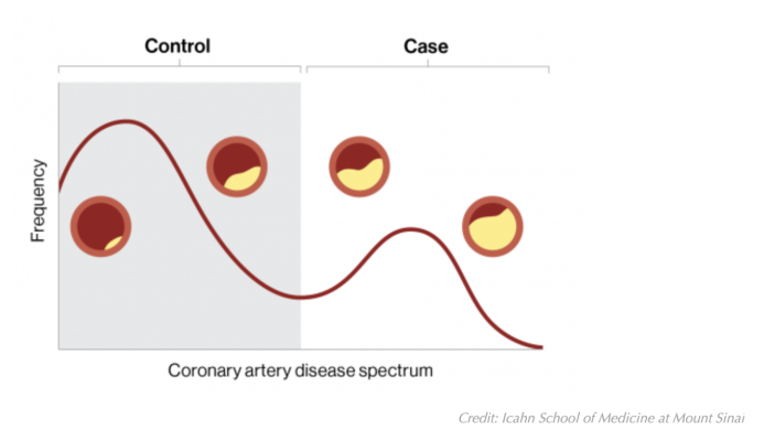 Individuals with coronary artery disease exist on a spectrum of disease, such as the amount of plaque build-up in the arteries of the heart; however, the disease is conventionally classified as broad categories of case (yes disease) or control (no disease), which may result in misdiagnosis. A digital marker for coronary artery disease derived from machine learning and electronic health records can better quantify where an individual falls on the disease spectrum. Credit: Icahn School of Medicine at Mount Si