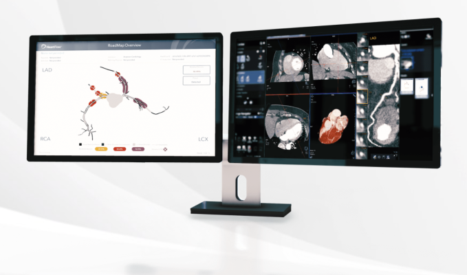Non-invasive, AI-enabled product helps CT readers to accurately, efficiently, and consistently identify narrowings in the coronary arteries, advancing the HeartFlow portfolio 
