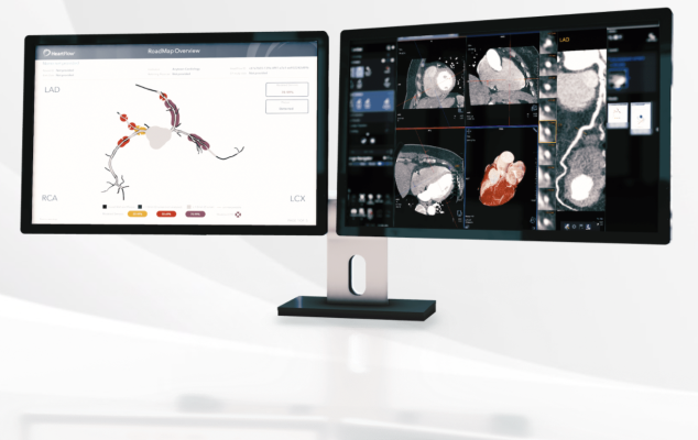 HeartFlow announced that new data on HeartFlow Plaque Analysis and its RoadMap Analysis will be presented at the 2023 Society of Cardiovascular Computed Tomography (SCCT) Annual Scientific Meeting in Boston, MA. 