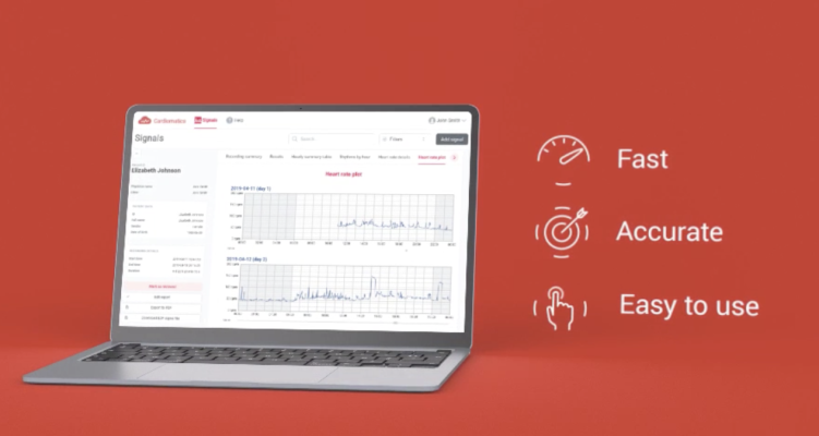The software updates introduce fast-track analysis and a user-friendly layout for quicker review of ECG findings, enhancing efficiency for medical professionals 