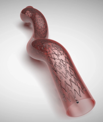 Clinical trial data released during VIVA 2023 Conference included results from a study involving the Veryan Medical BioMimics 3D Vascular Stent System.  