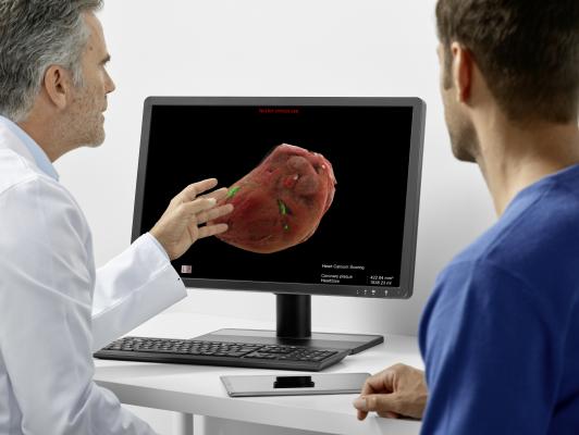 FDA Clears Modules of AI-Rad Companion Chest CT From Siemens Healthineers