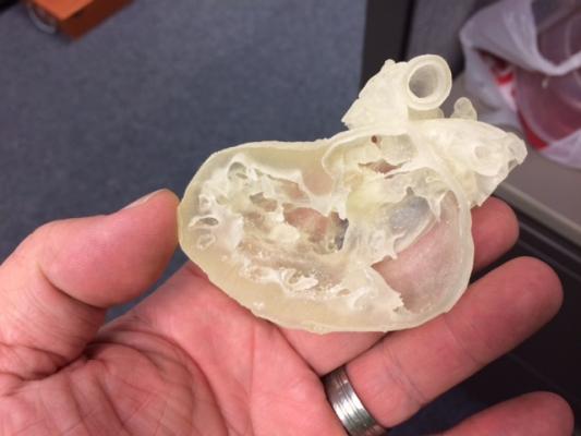 Nemours Children's Health System Uses 3-D Printing to Deliver Personalized Care