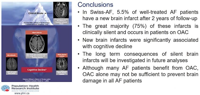 The Swiss-AF study shows High Incidence Of Silent Brain Infarcts Found in Anticoagulated Atrial Fibrillation Patients. #Heartrhythm2020 #HRS20 #HRS2020 