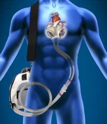 SynCardia Total Artificial Heart SynHall Valves FDA approval