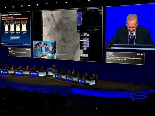 A live Corevalve TAVR case in the main arena at TCT 2017. Structural heart has moved from a science fiction discussion in future technology sessions at TCT a decade ago to now being a major portion of what the conference discusses for today's clinical practice.