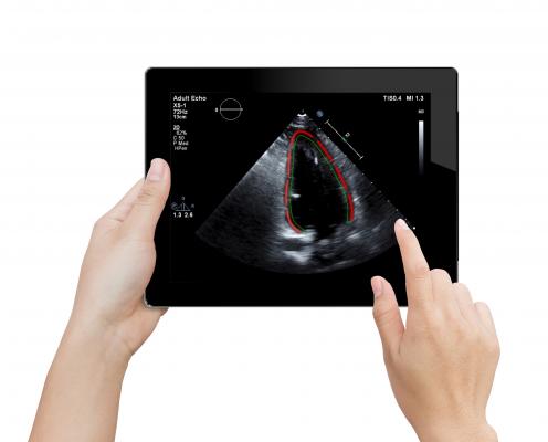 TomTec Unveils TomTec Zero Cardiovascular Viewing Software