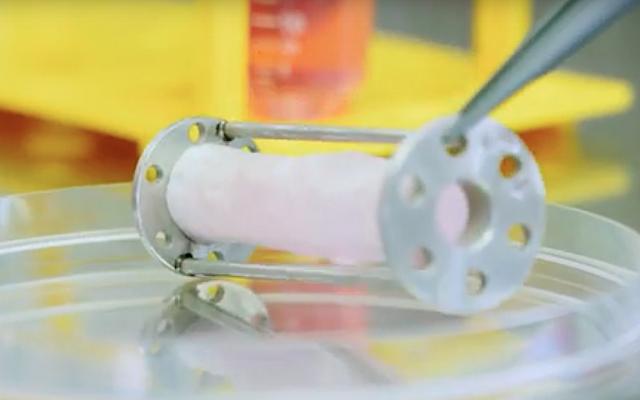 The Wyss Translational Center in Zurich, Switzerland has developed the LifeMatrix platform to engineer tissues that can be implanted in patients and will grow with them. This technology is being developed for heart valves in younger patients to eliminate the need for repeat surgeries to implant larger prosthetic heart valves as the patient grows.