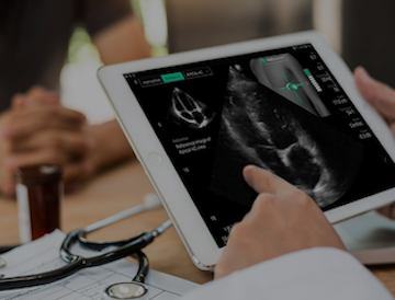 Jefferson Health, UltraSight Team Up to Expand Access to Cardiac Imaging