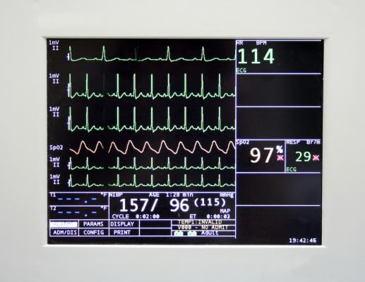 AI Could Use EKG Data to Measure Patient's Overall Health Status