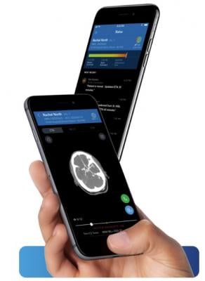 FDA Clears First AI-Powered Clinical Decision Support Software for Stroke